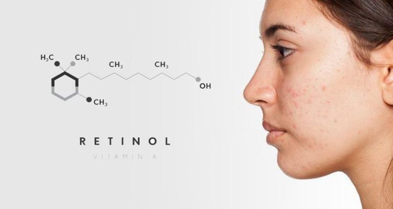 Lưu ý khi sử dụng retinol