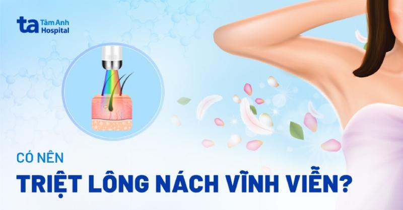 Kinh Nghiệm Chọn Gói Triệt Lông Hasaki