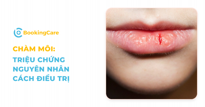 Nguyên nhân nhầm lẫn về Vaseline