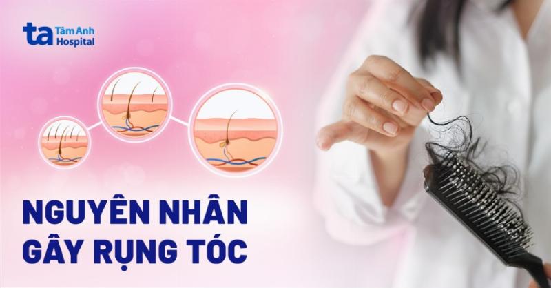 Nguyên nhân gây rụng tóc