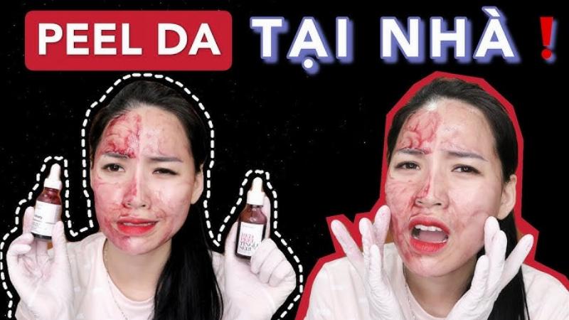 Các loại sản phẩm peel da