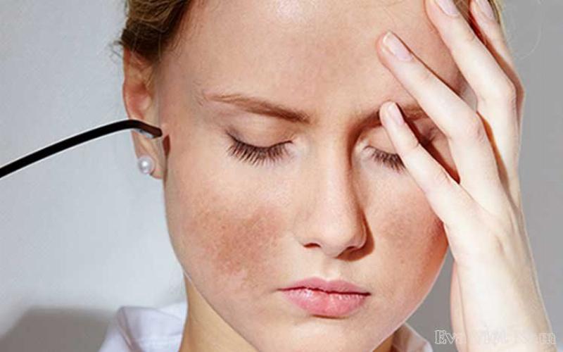 Cách sử dụng kem đánh răng trị nám (không khuyến khích)