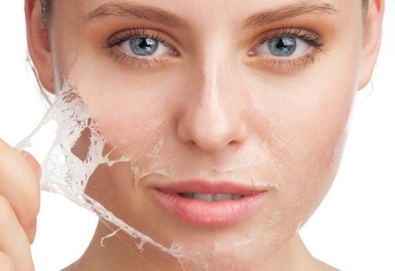 Lợi ích của việc peel da