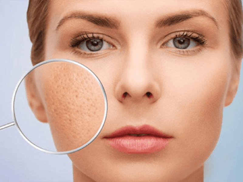 Mặt nạ thiên nhiên se khít lỗ chân lông hiệu quả