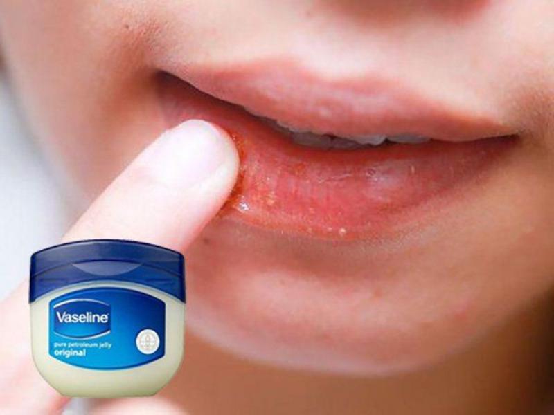 cach-boi-vaseline-len-moi-hieu-qua